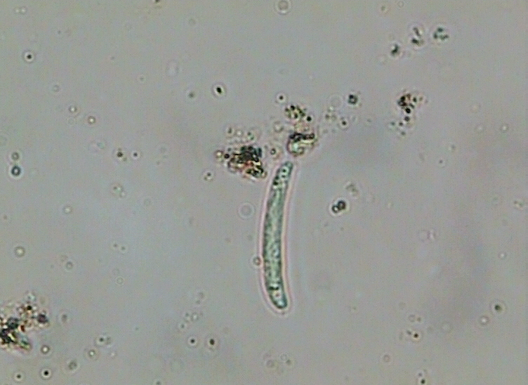 Dictyocha speculum